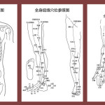 Acupuncture and Moxibustion Therapy- illustration -3