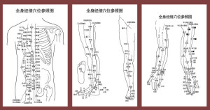 Acupuncture and Moxibustion Therapy3- illustration -